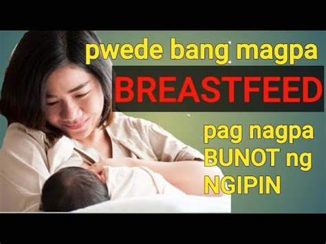 pwede ba magpabunot ng ngipin ang breastfeeding
